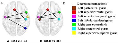 Common and Specific Characteristics of Adolescent Bipolar Disorder Types I and II: A Combined Cortical Thickness and Structural Covariance Analysis